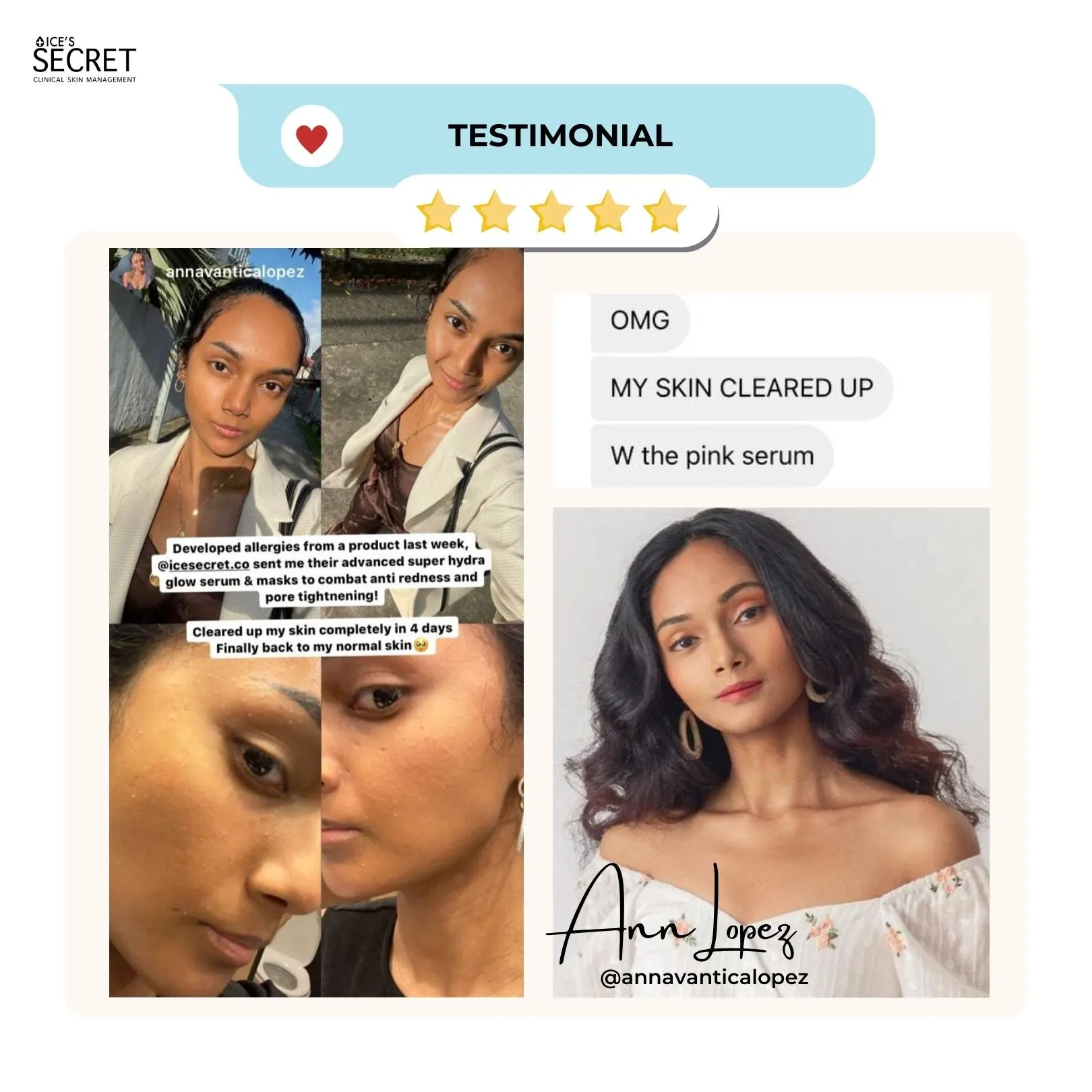 Bumpy, Textured and Dull Skin Kit