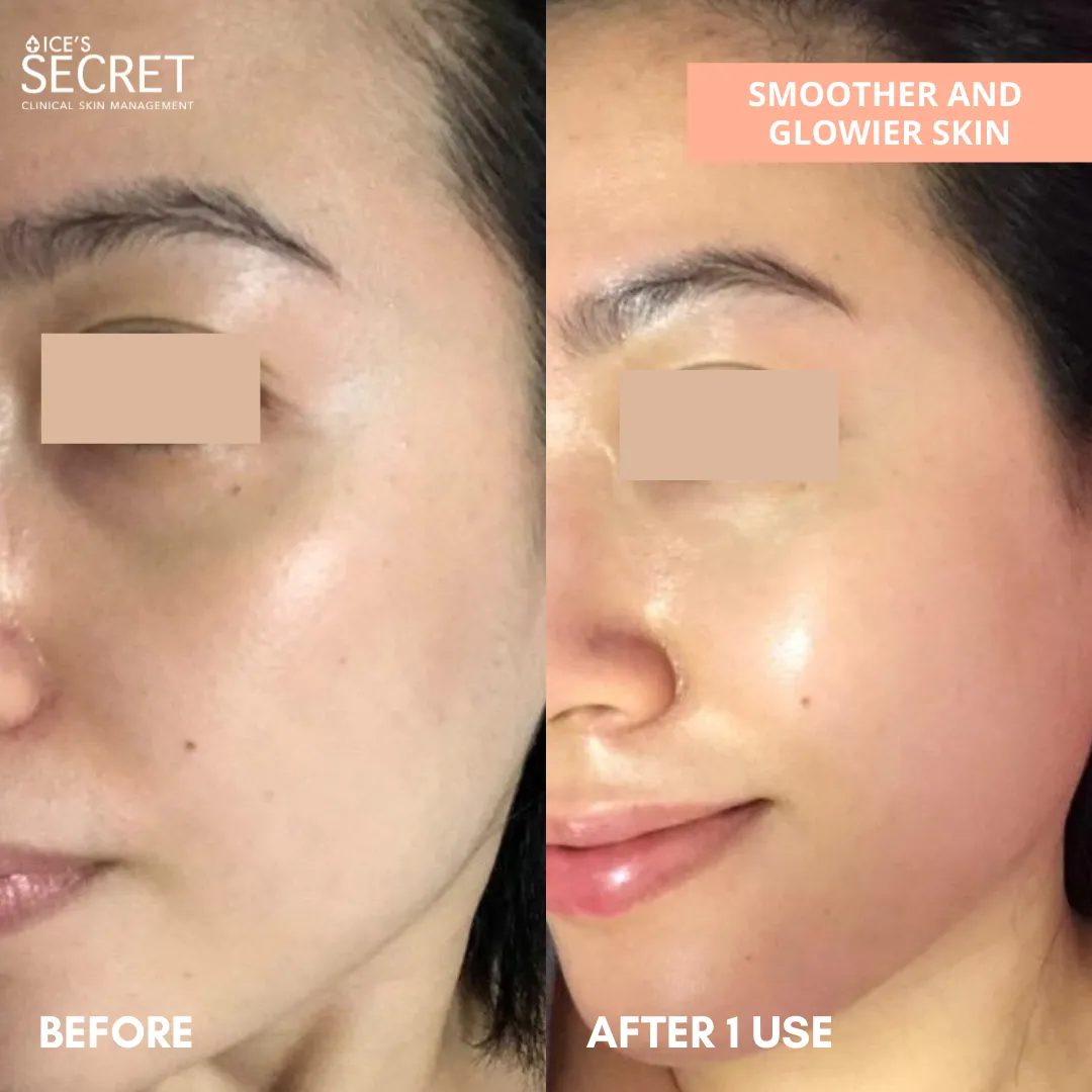 Bumpy, Textured and Dull Skin Kit