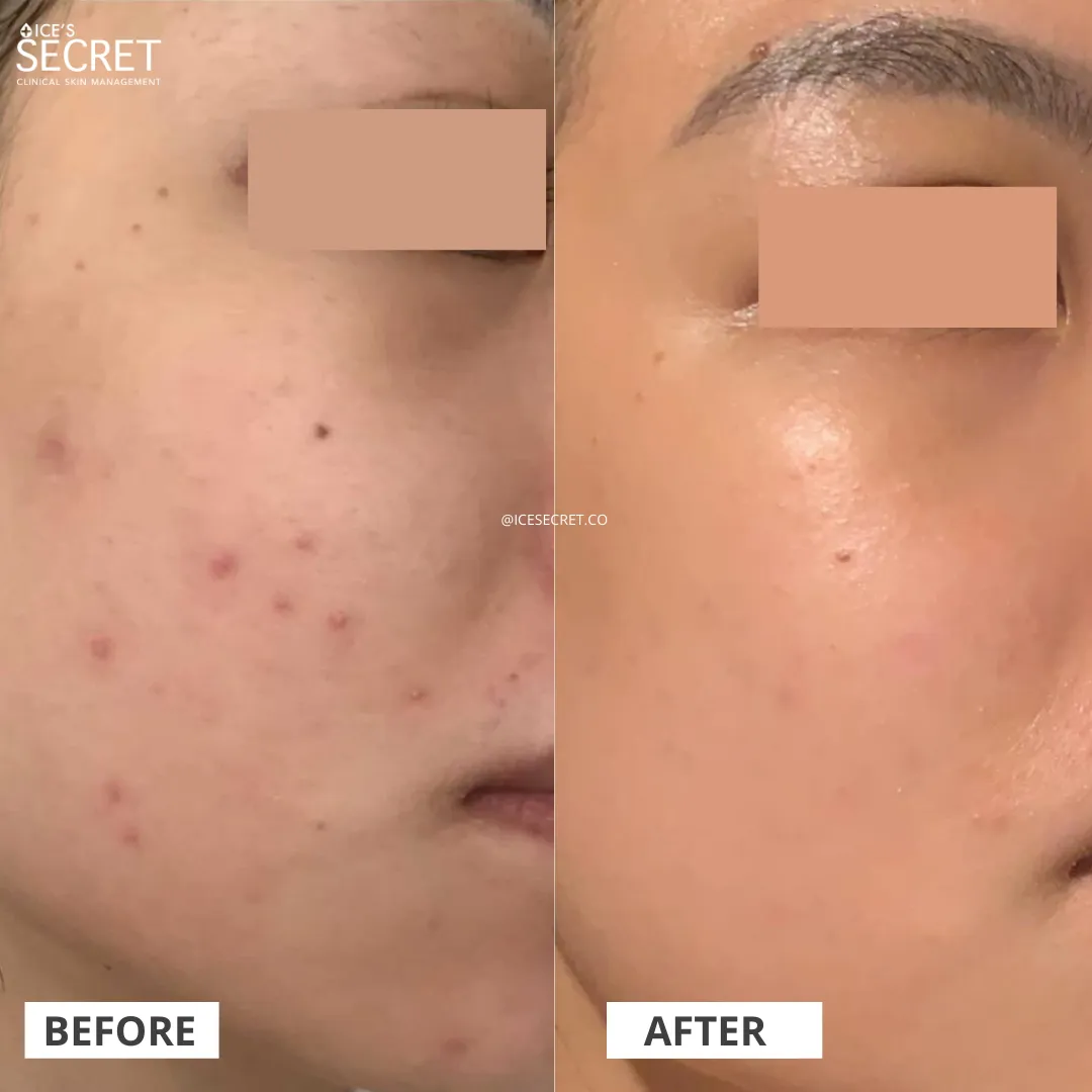 Bumpy, Textured and Dull Skin Kit