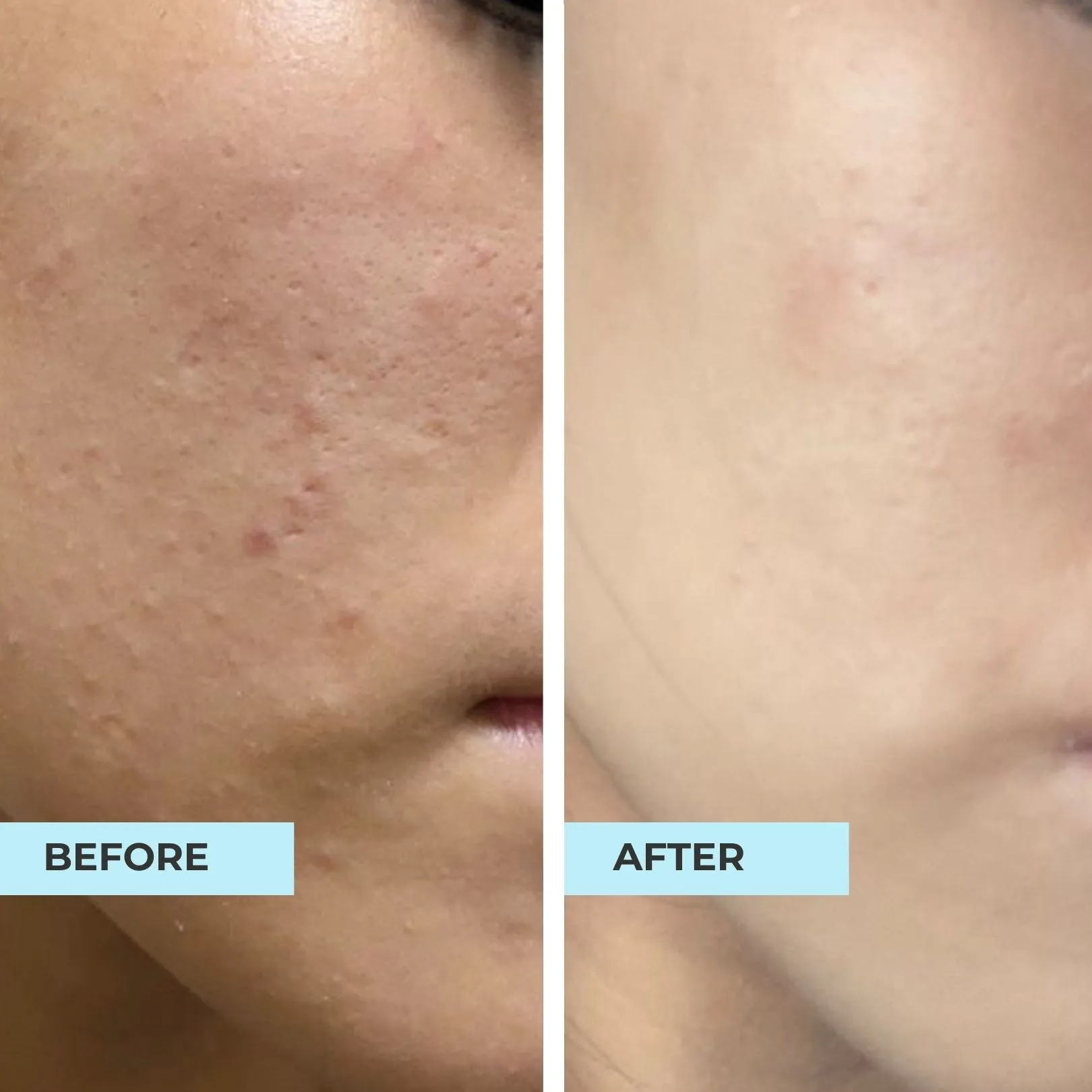 Bumpy, Textured and Dull Skin Kit