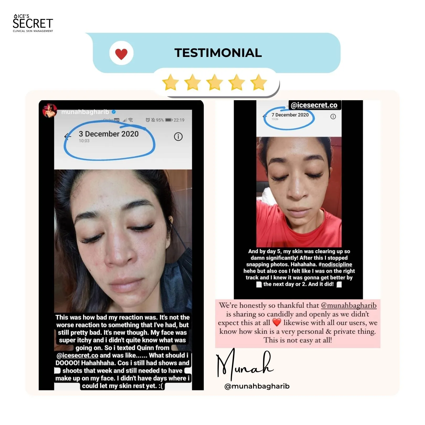 Bumpy, Textured and Dull Skin Kit