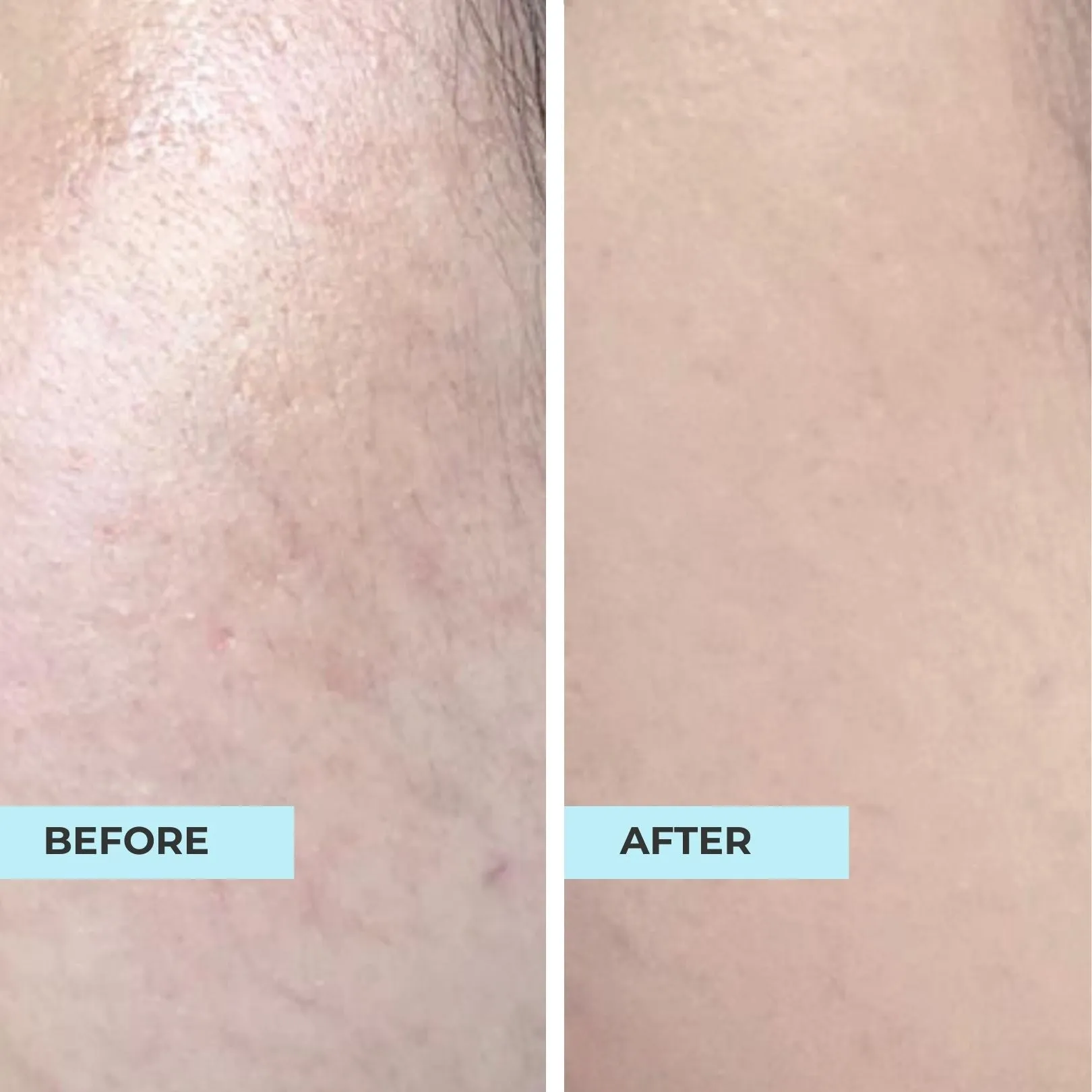 Bumpy, Textured and Dull Skin Kit