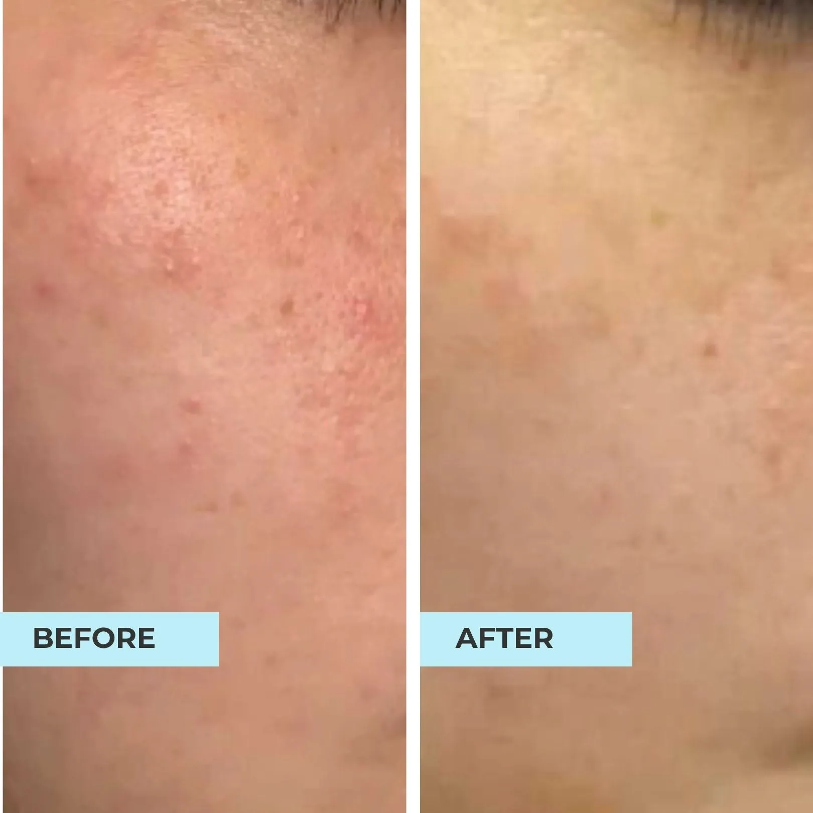 Bumpy, Textured and Dull Skin Kit